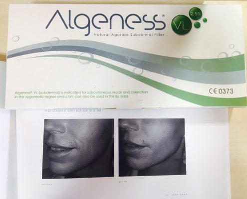 algeness articles
